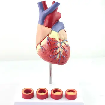 6 Deli Življenje Velikost Človeško Srce S Trombozo Model Medicinske Modeli Poučevanja