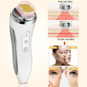 RF-Radijska Frekvenca Lifting Obraza Naprava Začetni Dot Matrix Lepoto Massager Gubam Odstranjevalec Zategovanja Kože Obraza Masaža Stroj